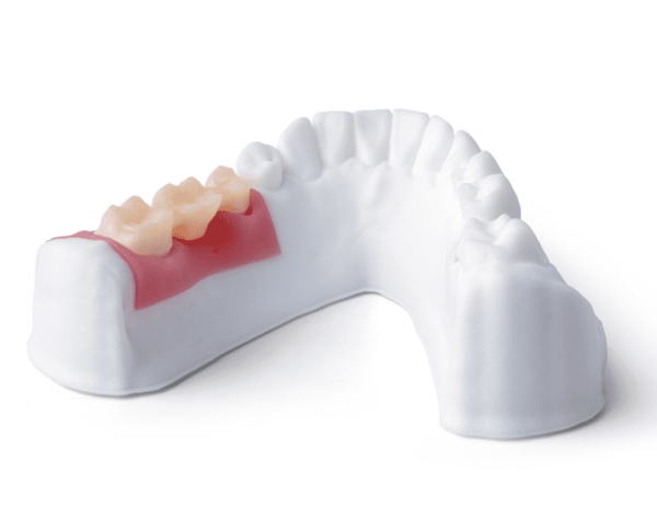 Phrozen Resin Gingiva Mask - Image 2