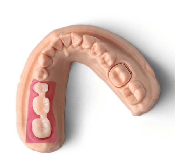 Phrozen Resin Gingiva Mask - Image 3