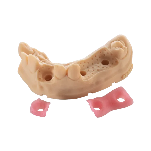 BASF Ultracur3D DM 2304 Gingiva Mask - Image 2