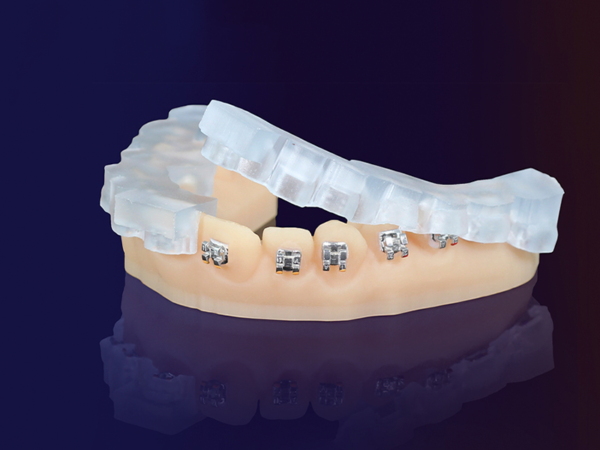 KeyPrint KeyOrtho IBT 0.5kg - Image 2