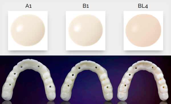 KeyPrint KeyDenture Try-In 1kg - Image 2