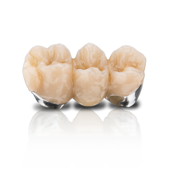 BEGO VarseoSmile Crown Plus A1 250g - Image 3