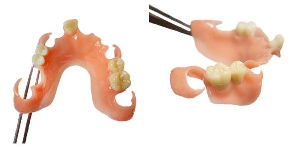 Harz Labs Dental Denture Base Soft 1kg - Image 4